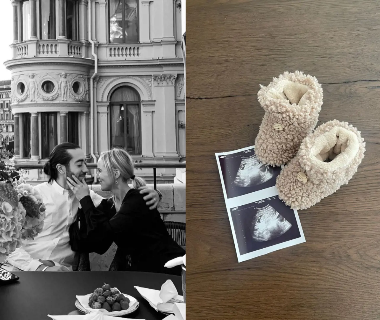 Mika and Irma are expecting a baby girl in 2023 as they share ultrasound image.